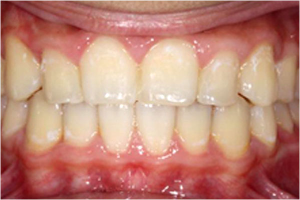 Orthodontics After