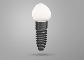 Are Dental Implants Right for me